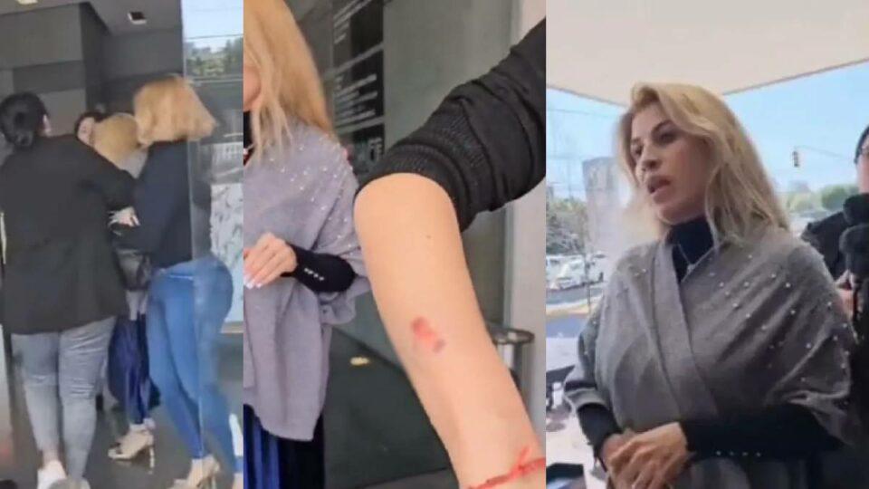 Una mujer agredió físicamente a las trabajadoras de un spa de uñas