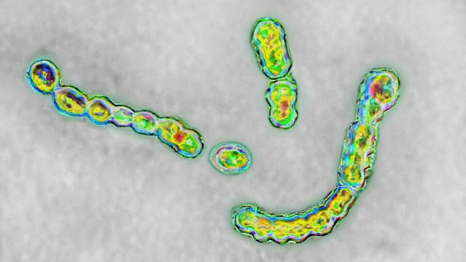 Una bacteria carnívora mortal se está propagando a un ritmo récord y nadie sabe por qué