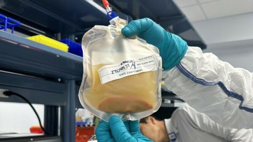 Cultivan un 'minihígado' en un paciente