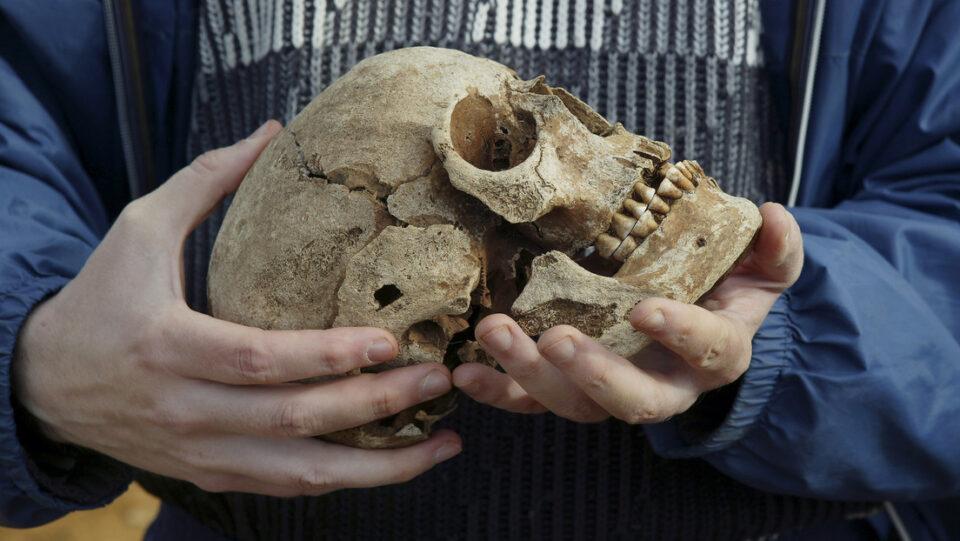 Descubren una prótesis única de hace 300 años, hecha de oro, cobre y lana