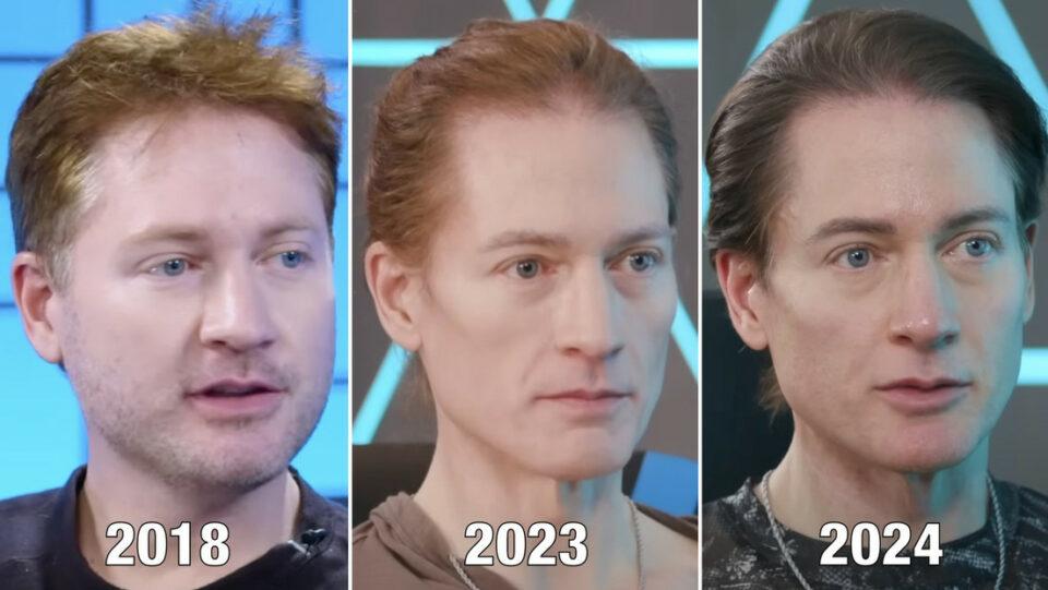 'Biohacker' multimillonario muestra el progreso de revertir su envejecimiento