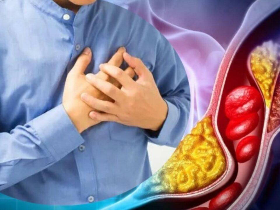 Según Harvard estos son los mejores alimentos para disminuir el colesterol malo