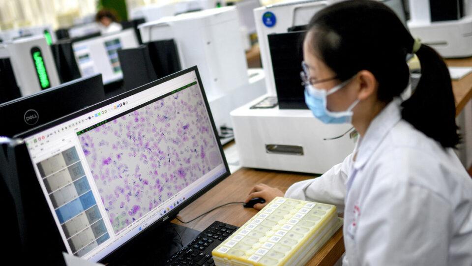 Científicos sugieren que la IA podría ayudar a detectar el cáncer en etapa temprana