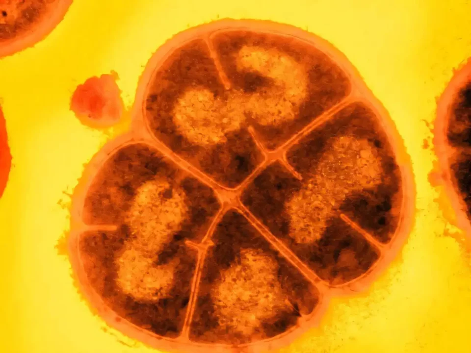 Descifran el secreto de la bacteria más resistente a la radiación