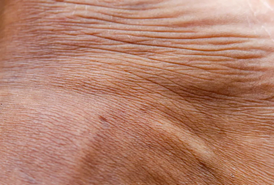 ¿Vacunas sin agujas? El secreto podría estar en el sistema inmune de la piel