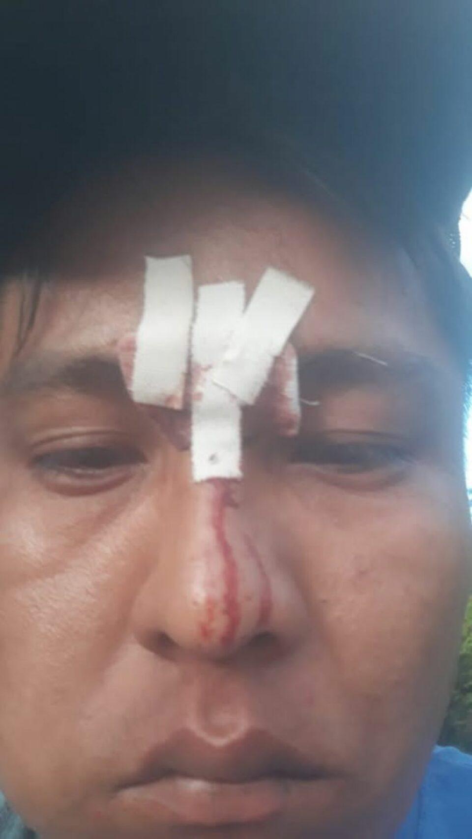 Yacuiba: enfrentamientos entre comunarios y Policía dejan heridos y destrozos