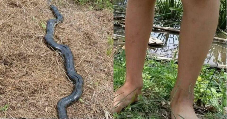 Niño de 10 años es atacado por una sicurí de dos metros en Beni