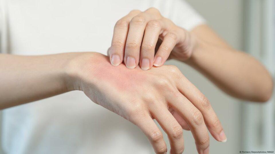 La ciencia revela los beneficios y efectos perjudiciales al rascarse