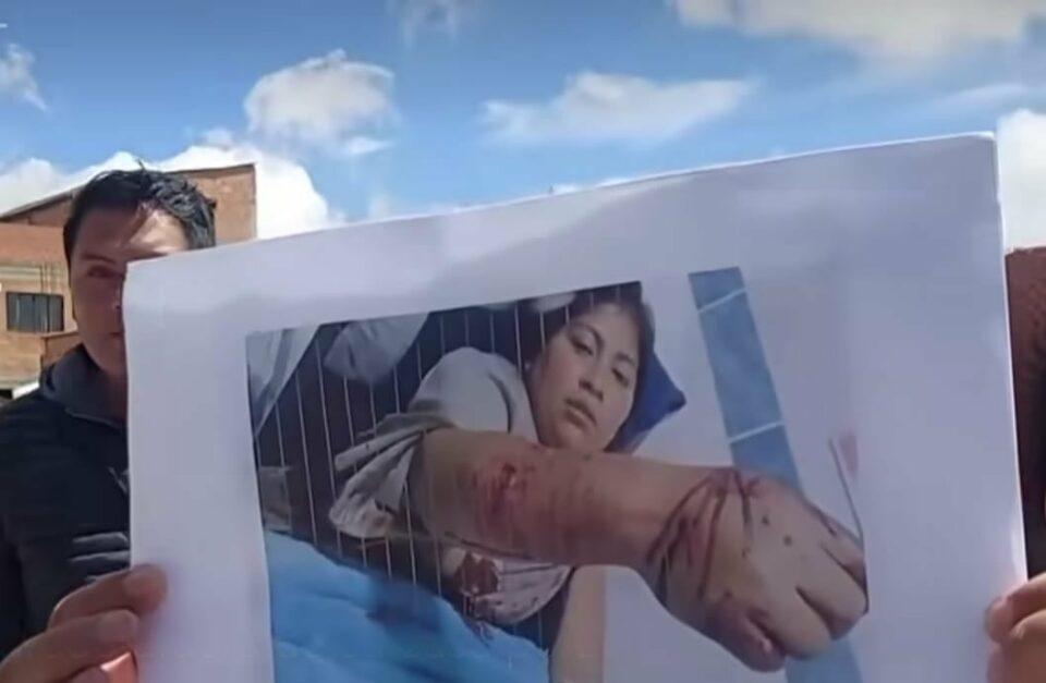 Tres perros pitbull atacan a una mujer en El Alto