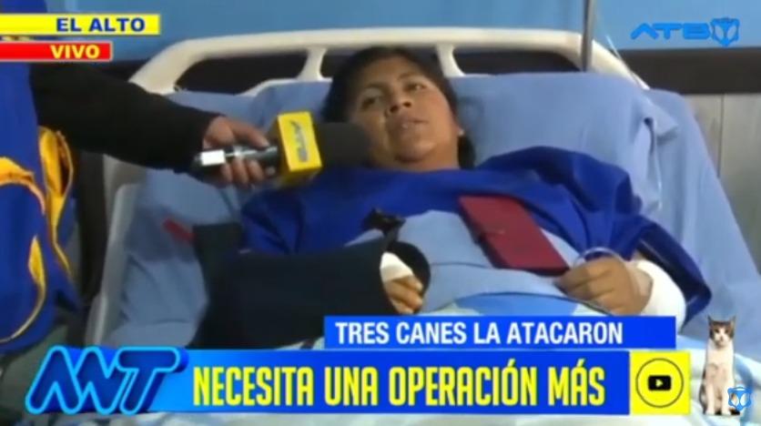 Una mujer fue atacada por tres canes en la ciudad de El Alto
