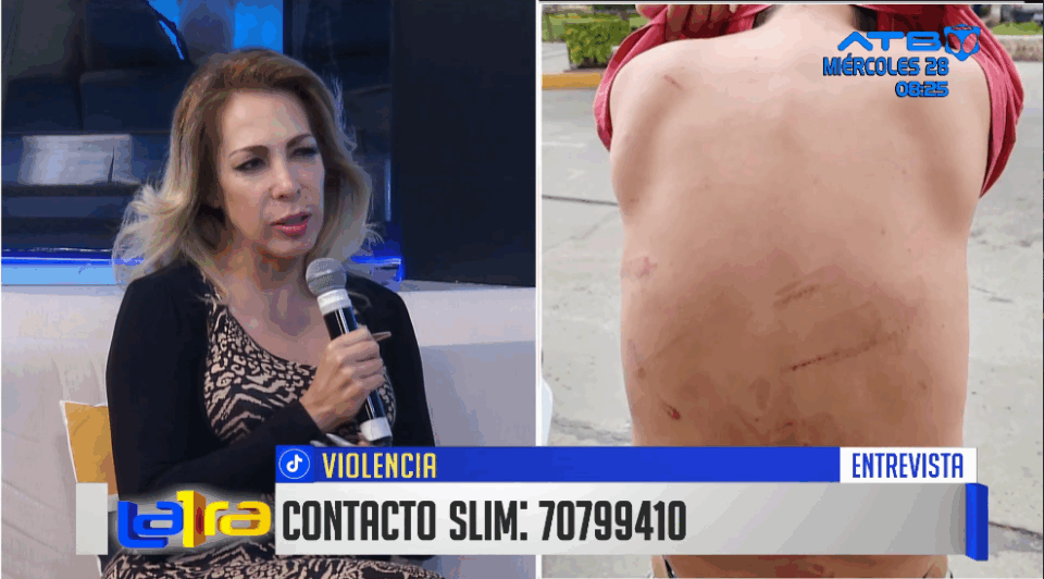 Cochabamba: reportan tres hombres agredidos por sus parejas