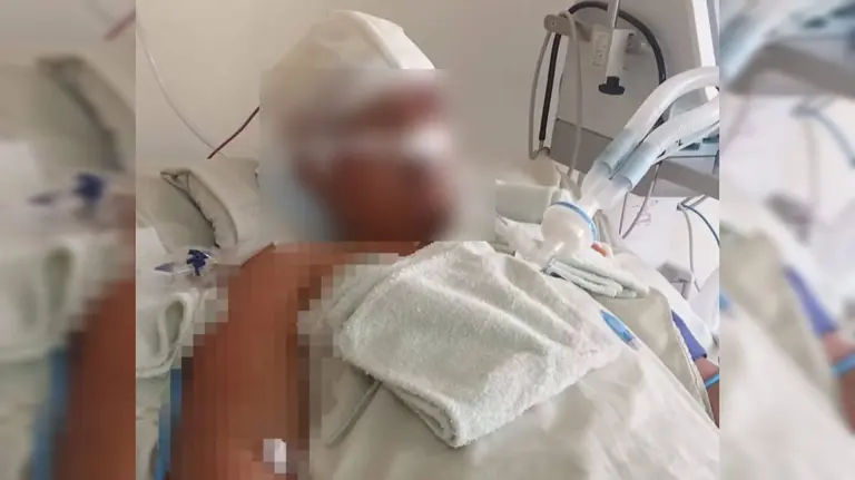 42 días en terapia: Analy lucha por su vida tras ataque de su pareja; familia pide ayuda