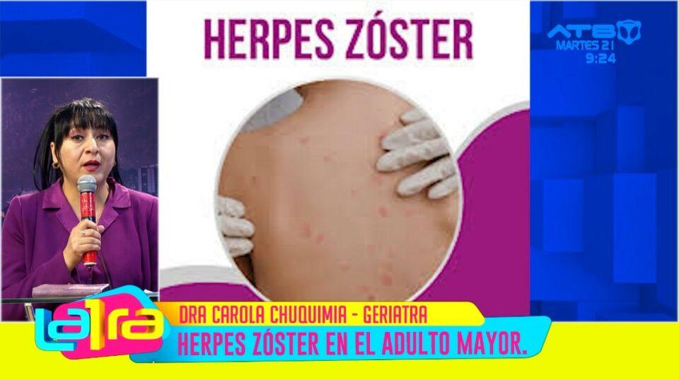 Herpes zóster, la infección que más se presenta en adultos mayores