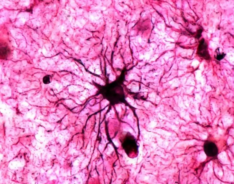 Científicos identifican la parte del cerebro que resguarda los recuerdos con carga emocional