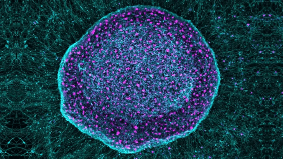 Una ´esponja´ evita que sientas dolor crónico: conoce la nueva apuesta científica