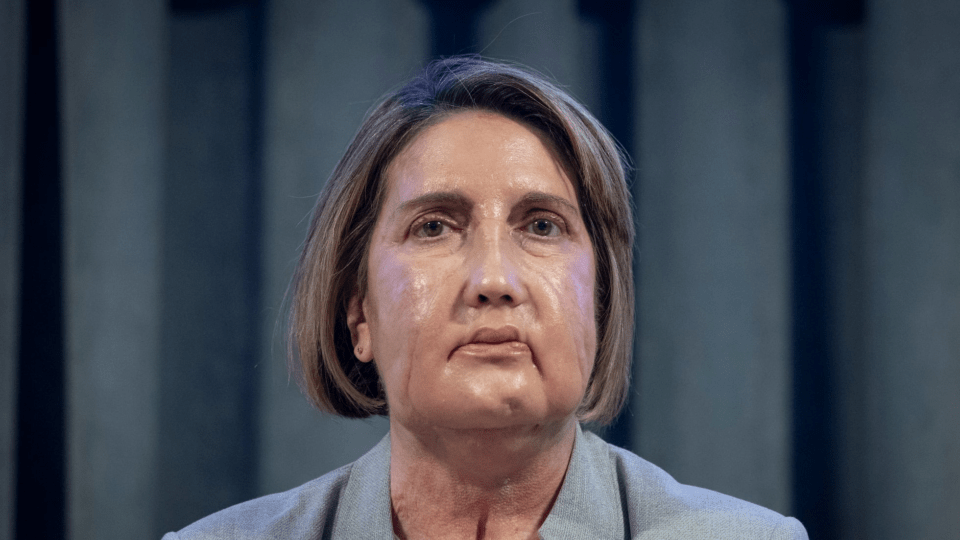 España: Vall d'Hebron logra primer trasplante de cara en el mundo con una donante que había recibido eutanasia