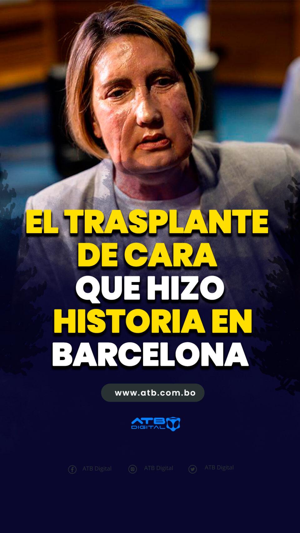 El trasplante de cara que hizo historia en Barcelona