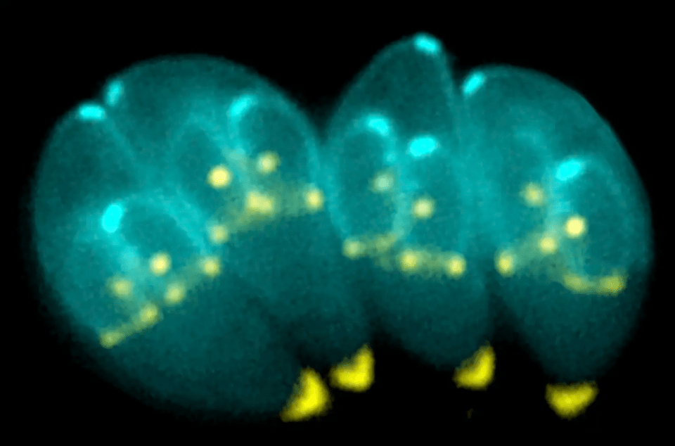 Una investigación revela cómo actúa un parásito que tiene un tercio de la población mundial en el cerebro humano