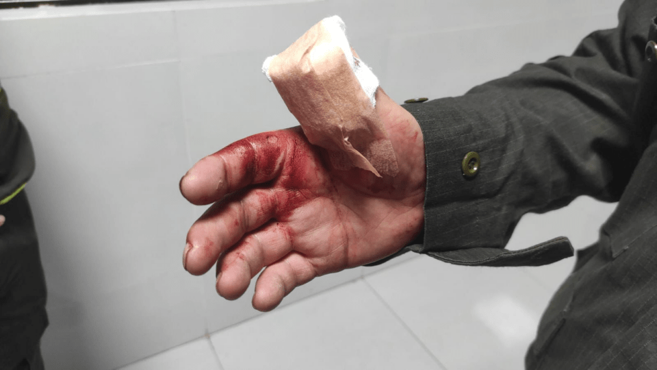 Amenazó a transeúntes en Cochabamba y un policía resultó herido: aprehenden a sujeto con arma blanca